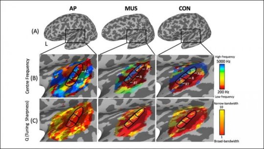 study-absolute-pitch-may-be-more-strongly-under-genetic-control-than