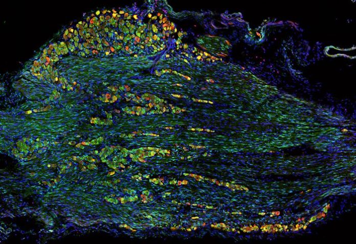 Researchers identify neural disruptions underlying feeding, swallowing disorders in children