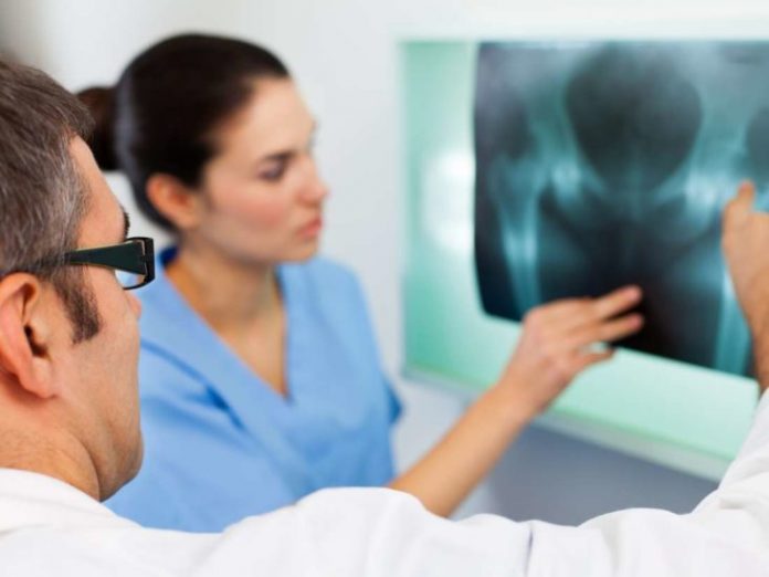 Osteoporosis screening inadequate for women aged 50-64